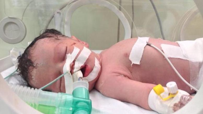 Γάζα: Πέθανε το μωρό "θαύμα";