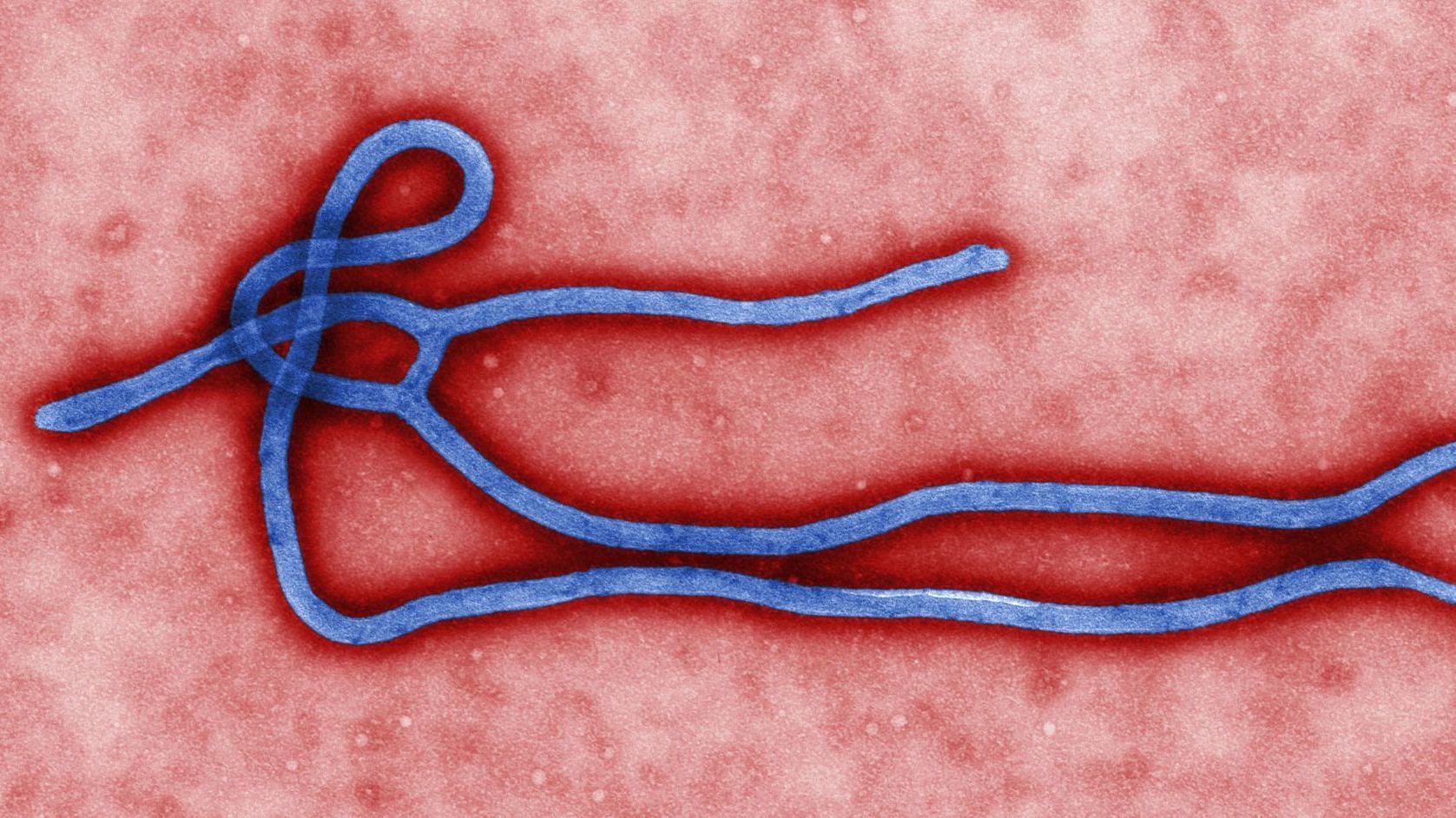 Ενημέρωση του ΚΕΕΛΠΝΟ για τον Ebola