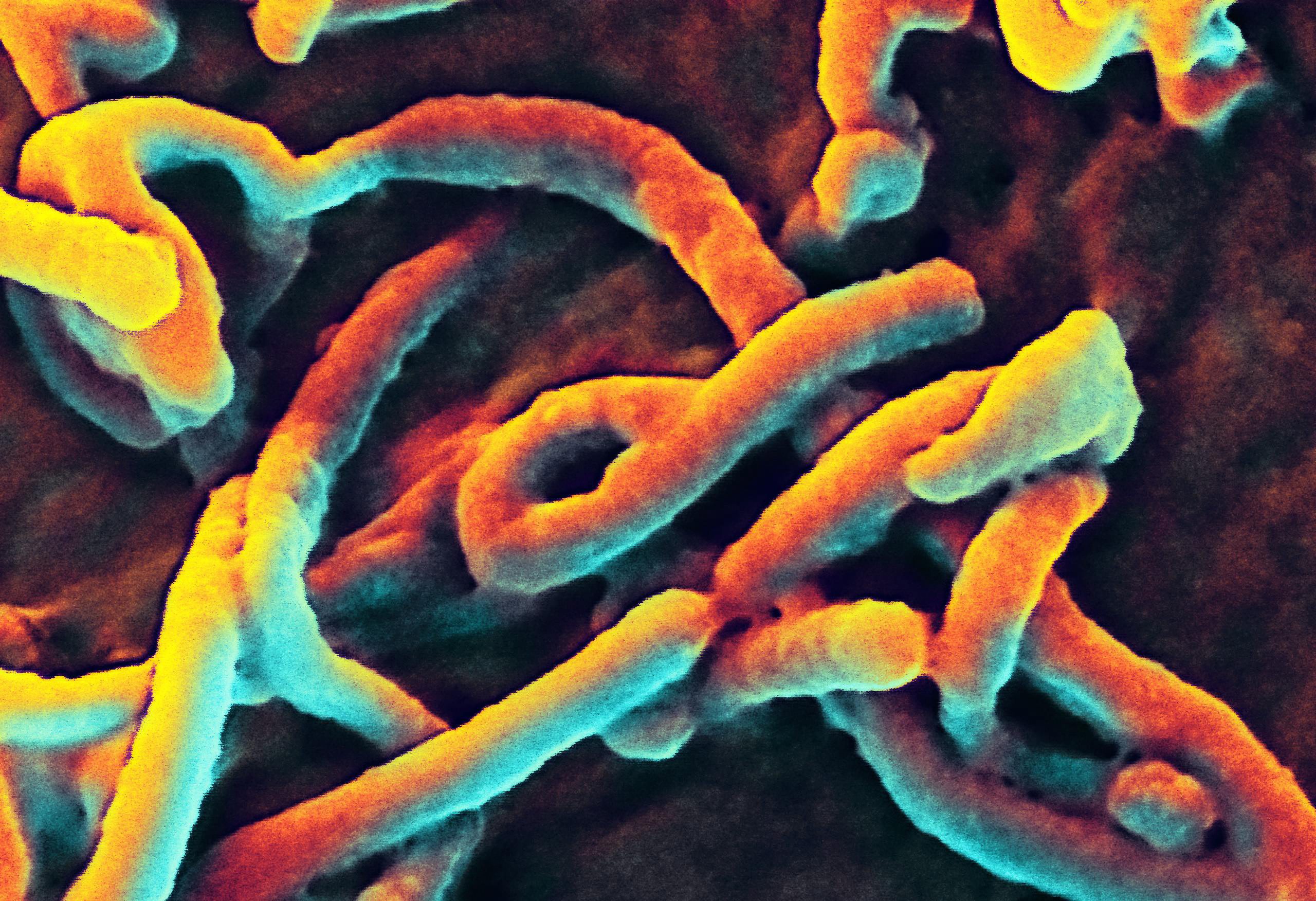 Τρόμος για τον Ebola (φωτο-video)