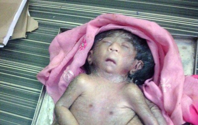 Ινδία: Μωρό με οκτώ άκρα λατρεύεται σα θεός