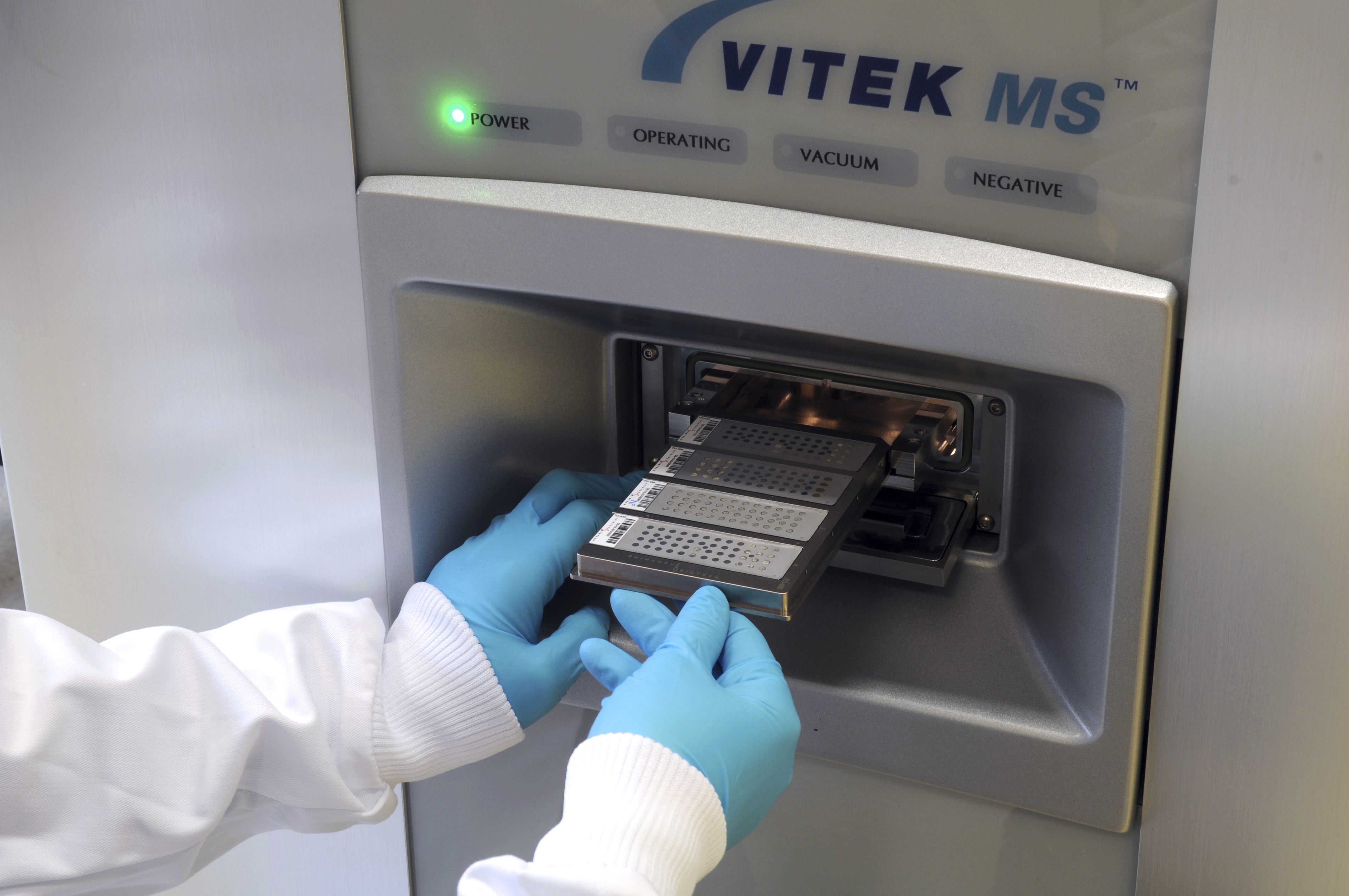 ΟΜΙΛΟΣ ΥΓΕΙΑ: Αποτελέσματα μικροβιολογικών εξετάσεων σε λίγα λεπτά  με το σύστημα VITEK MS