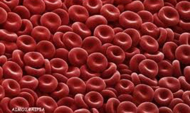 Πρησμένη σπλήνα και πολλά αιμοσφαίρια υποδηλώνουν πολυκυτταραιμία μια σπάνια αλλά θανατηφόρο νόσο
