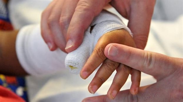 Η πρώτη στον κόσμο μεταμόσχευση χεριών σε παιδί