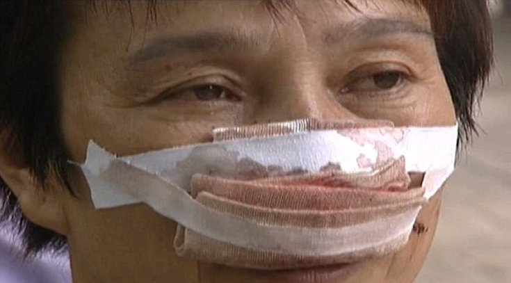 Φωτογραφίες ΣΟΚ: Δάγκωσε, έκοψε και κατάπιε τη μύτη της πρώην γυναίκας του