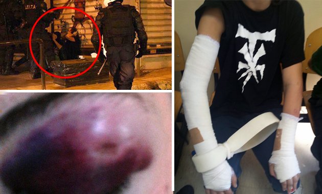 Αστυνομικοί της ομάδας ΔΕΛΤΑ χτύπησαν ανελέητα ανήλικους αφού πρώτα τους φόρεσαν χειροπέδες (φωτό)