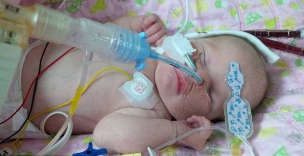 Δωρεάν καρδιολογική επέμβαση σε νεογνό 13 μηνών
