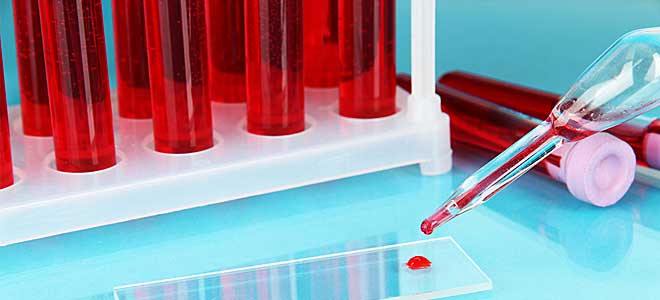Επαναστατικό τεστ αίματος κάνει πρώιμη διάγνωση σε όλες τις μορφές καρκίνου