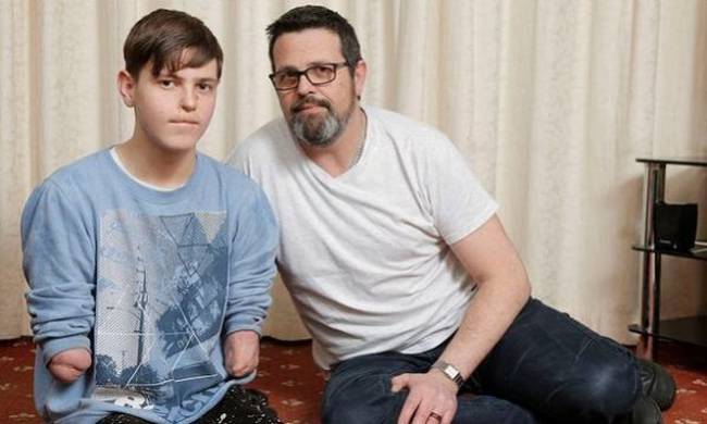 Έφηβος με ακρωτηριασμένα άκρα κλήθηκε να αποδείξει την αναπηρία του!
