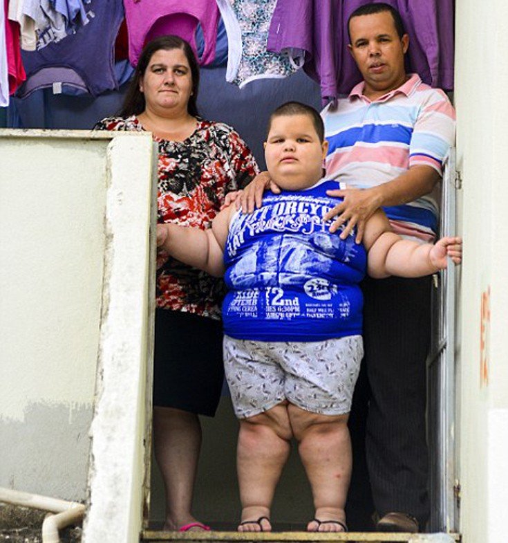 Η ιστορία του 5χρονου που ζυγίζει 79 κιλά