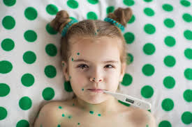 Ανεμοβλογιά: Η παιδική ασθένεια της άνοιξης