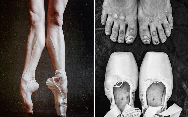 Πώς γίνονται τα πόδια μιας μπαλαρίνας μετά από τις παραστάσεις (photos)