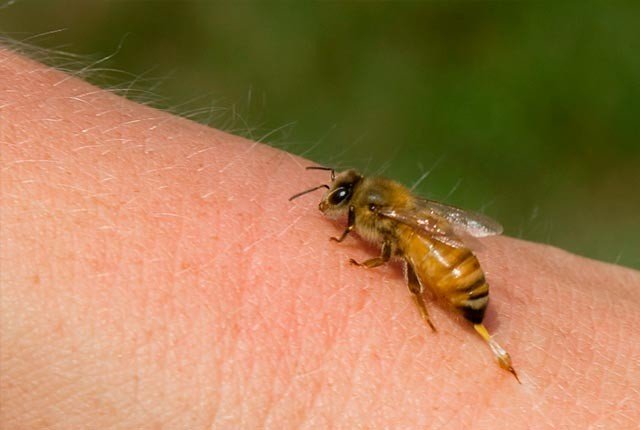 Πώς θα ανακουφιστείτε άμεσα από το τσίμπημα της μέλισσας