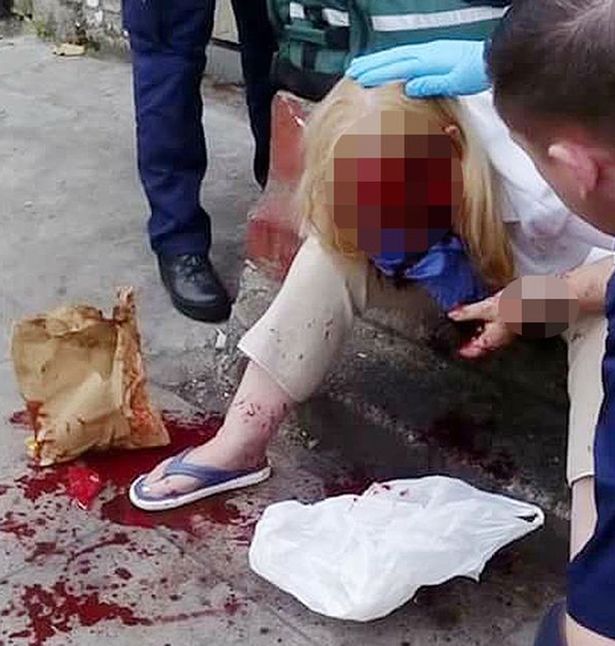 Απίστευτες εικόνες: Τη χτυπούσε με σφυρί στο κεφάλι στη μέση του δρόμου