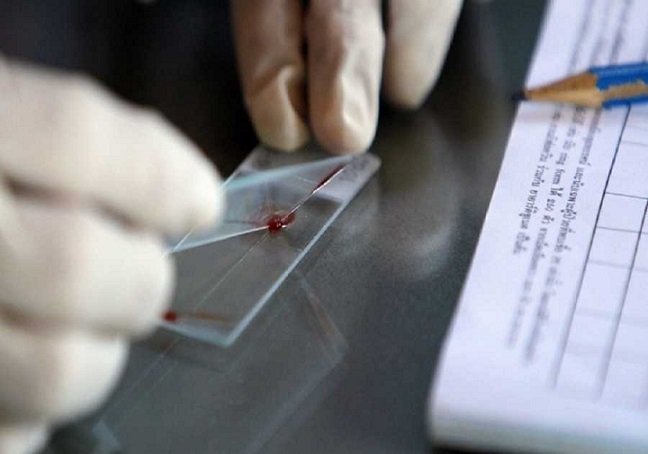 Υπ. Υγείας: Ελεγχόμενα τα σποραδικά κρούσματα ελονοσίας - Κανένας κίνδυνος για τη δημόσια υγεία