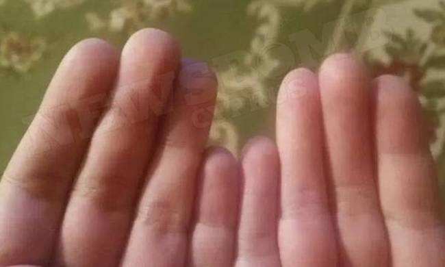 Μοιάζουν φυσιολογικά- Μπορείς να εντοπίσεις τι «λείπει» από αυτά τα δάκτυλα; (photo)
