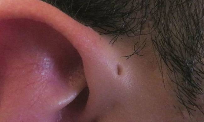 Εσείς γνωρίζετε τι σημαίνει αυτή η τρύπα στα αυτιά μερικών ανθρώπων;