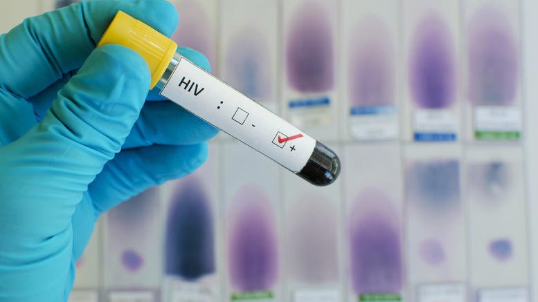 Ξεκινά η μεγαλύτερη δοκιμή ενός νέου εμβολίου κατά του AIDS