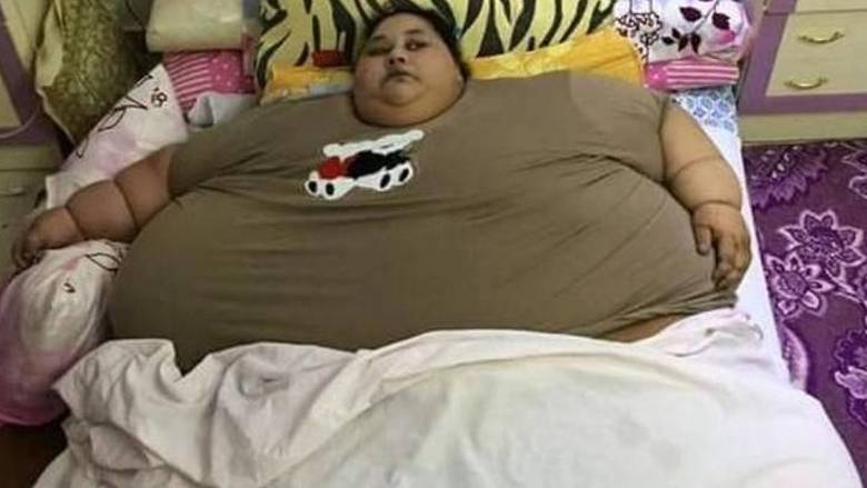 Γυναίκα που ζυγίζει 500 κιλά μπαίνει στο χειρουργείο για να σώσει τη ζωή της