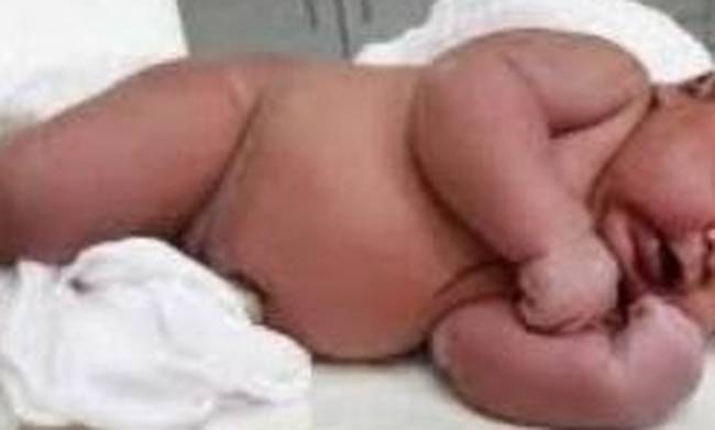 Μωρό... γίγας γεννήθηκε στην Αυστραλία και έχει τρελάνει τους γιατρούς (Photo)