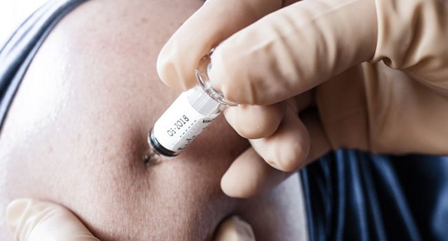 Επιτυχής η πρώτη δοκιμή εμβολίου σε ανθρώπους για την ελονοσία