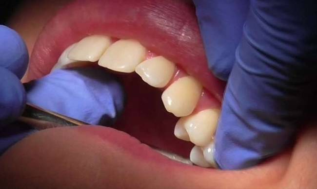 Έπιασαν στα πράσα «οδοντίατρο» που σπούδασε από το Youtube