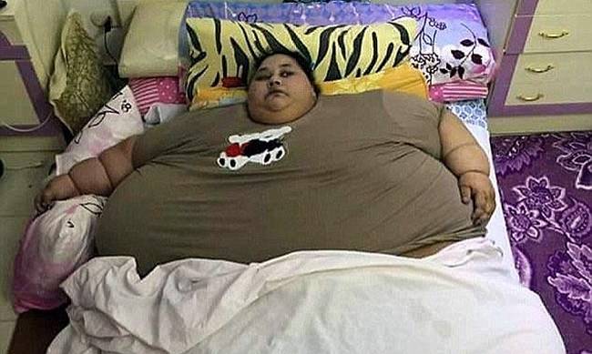 Με ειδική πτήση μεταφέρεται στην Ινδία για χειρουργείο η πιο παχύσαρκη γυναίκα στον κόσμο (pics)