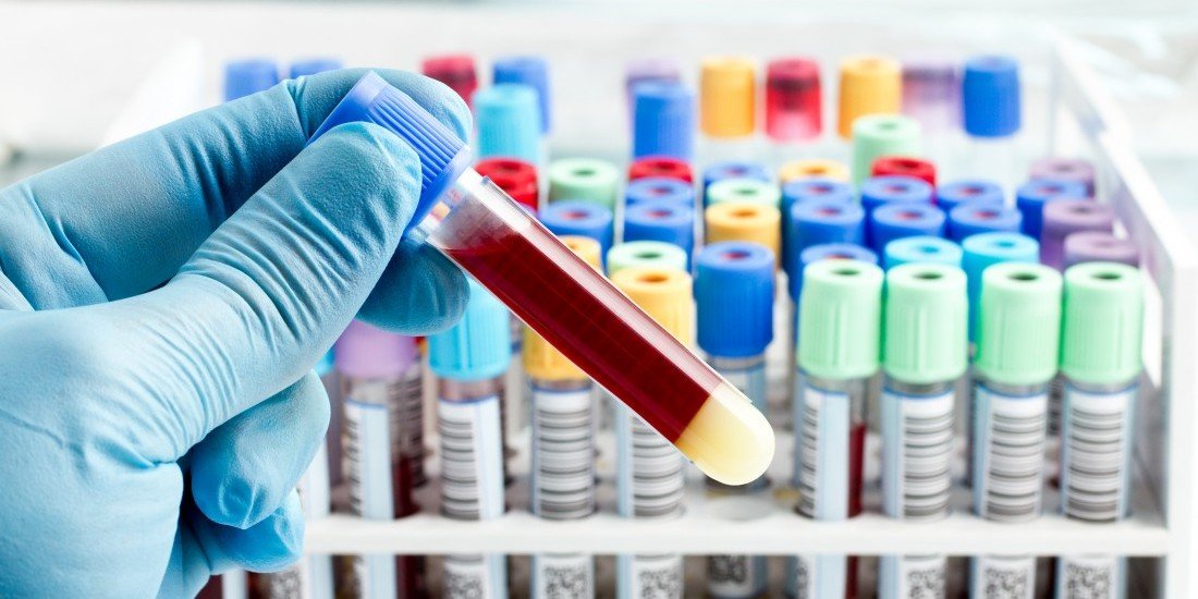 Απλό τεστ αίματος μπορεί να διακρίνει έγκαιρα το Πάρκινσον