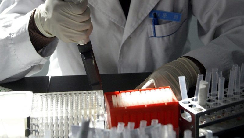 Πειραματικό διαγνωστικό τεστ αίματος «πιάνει» νωρίτερα τον καρκίνο του παγκρέατος