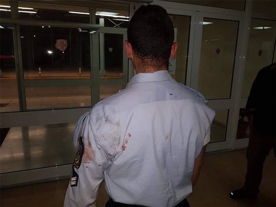Αιμόφυρτοι αστυνομικοί από επίθεση που δέχθηκαν από Ρομά