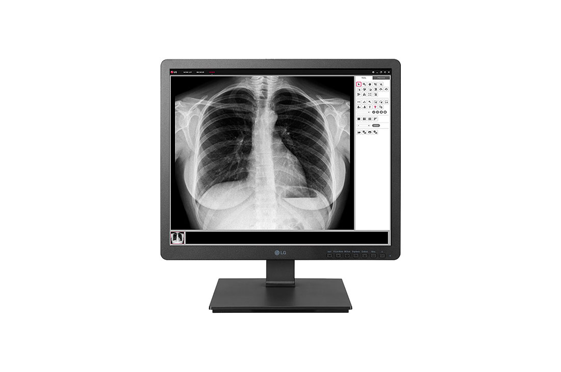 Η LG παρουσιάζει τη νέα σειρά ιατρικών συσκευών απεικόνισης