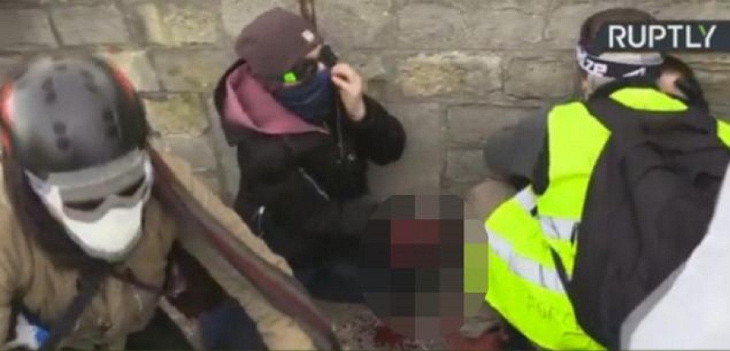 Ένταση στο Παρίσι: Διαδηλωτής από τα Κίτρινα Γιλέκα έχασε το χέρι του