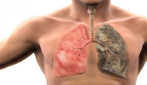 (PHOTO) Σοκαριστικό βίντεο: Τι κάνει το τσιγάρο στους πνεύμονες - Δείτε το πείραμα