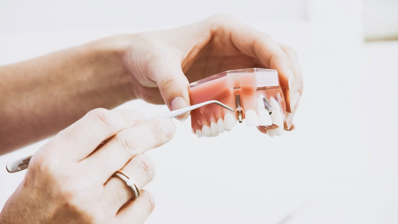 Γερμανία: Οδοντίατρος αφαίρεσε το μεγαλύτερο δόντι του κόσμου