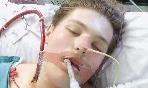 Ηλεκτρονικό τσιγάρο: Έφηβος με πνευμονική ανεπάρκεια στην εντατική από το άτμισμα!