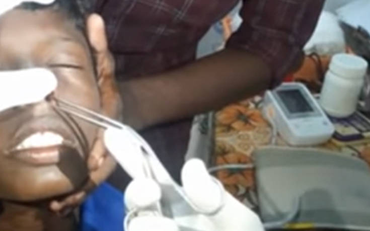 Γιατρός έβγαλε ψάρι από το ρουθούνι 13χρονου αγοριού (Video)