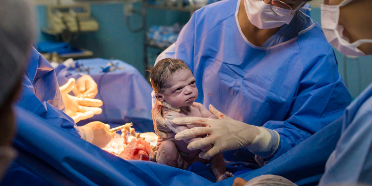 Μωρό κοιτάει απειλητικά την μαιευτήρα και γίνεται viral