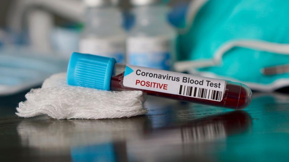 Κορωνοϊός Ελλάδα: 2η στην λίστα με τα λιγότερα τεστ για τον ιό