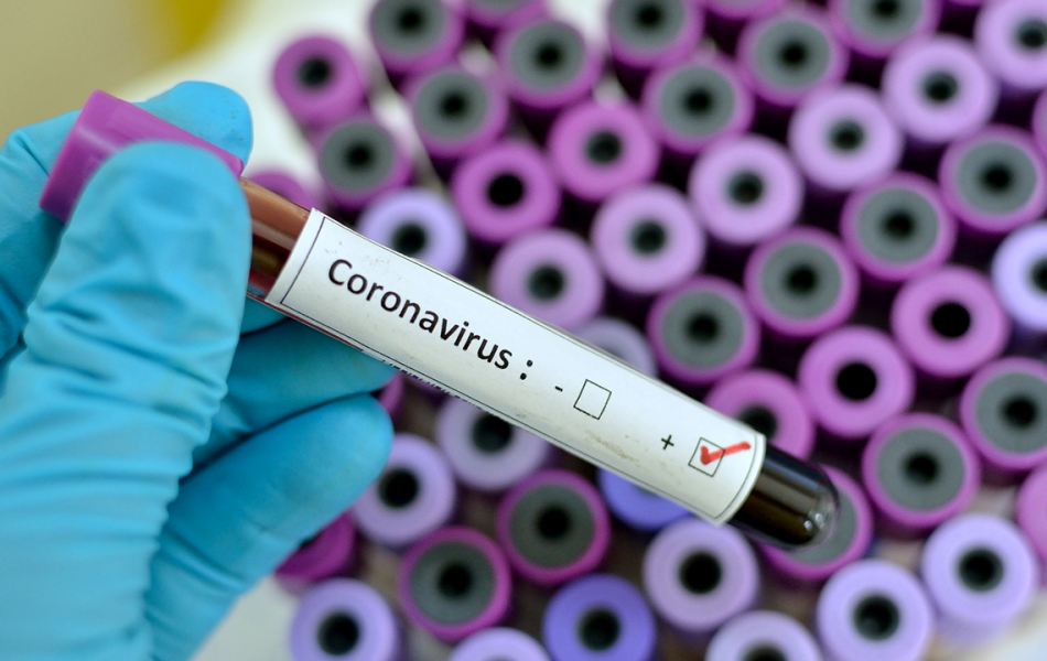 Kορωνoϊός: «Αποτελεσματικά τα φάρμακα κατά ελονοσίας και HIV» λένε Αυστραλοί επιστήμονες