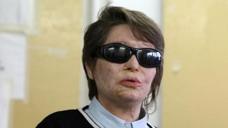 «Ό,τι πιο φρικτό έχω ζήσει» - Η πρώην ευρωβουλευτής Κ. Κούνεβα θυμάται τη δική της επίθεση με βιτριόλι