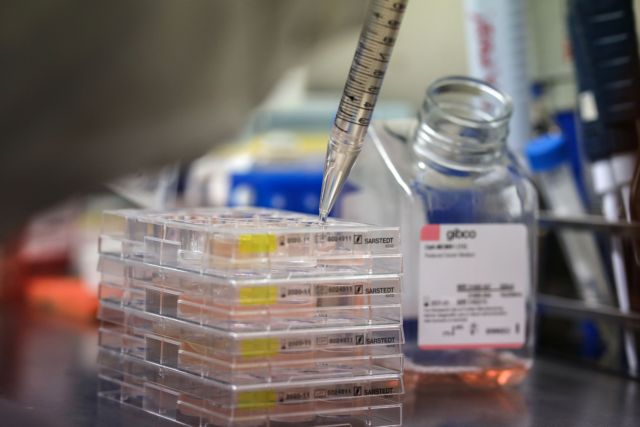 Οξφόρδη: Δύσκολα θα είναι έτοιμα 2,5 εκατομμύρια δόσεις του εμβολίου το φθινόπωρο