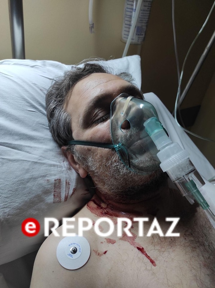 Αυτός είναι ο δράστης που πυροβόλησε τον Στέφανο Χίο (φωτογραφίες)