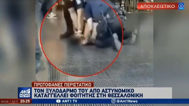 Θεσσαλονίκη: Φοιτητής καταγγέλλει τον ξυλοδαρμό του από αστυνομικό - Τι αναφέρουν πηγές της ΕΛ.ΑΣ.
