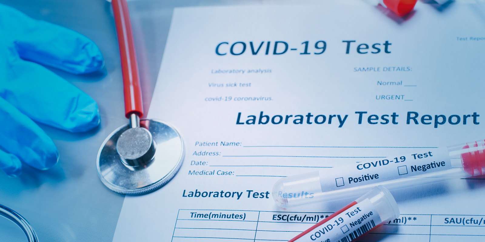 Η ανάγκη για περισσότερα και καλύτερα τεστ για COVID-19