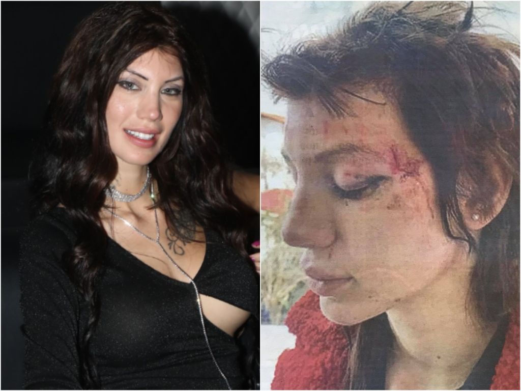 Μαρία Αλεξάνδρου: Η γνωστή ηθοποιός ερωτικών ταινιών καταγγέλλει απαγωγή και άγριο ξυλοδαρμό από έξι γυναίκες