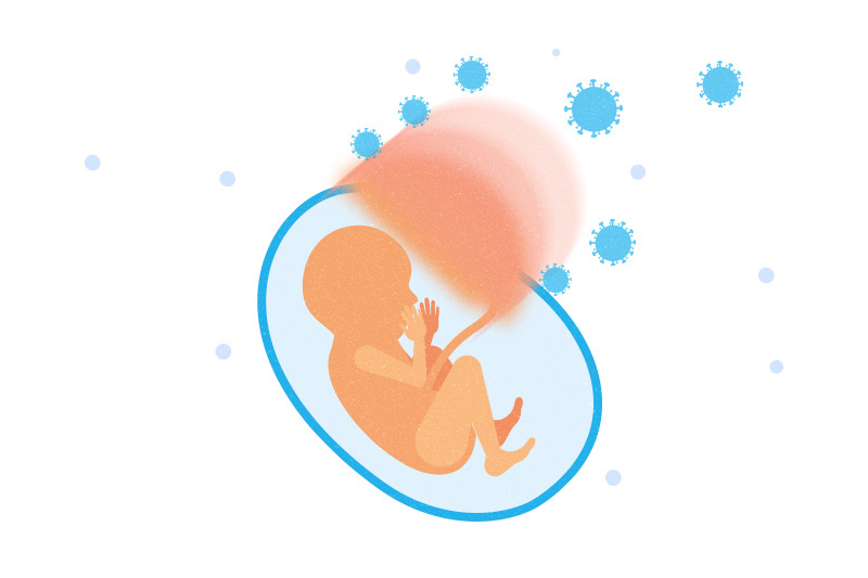 Κορωνοϊός: Έμβρυο πέθανε στην κοιλιά της μητέρας του – Πώς μολύνθηκε