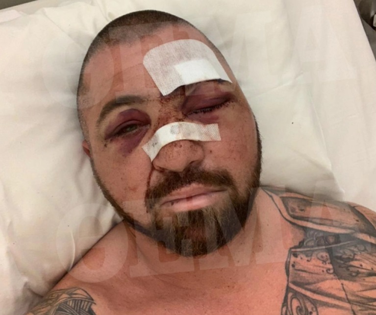 Μύκονος: Συνελήφθησαν οι δράστες της επίθεσης στον σωματοφύλακα του «Βασιλιά του Instagram» - Τι λέει ο ίδιος από το νοσοκομείο
