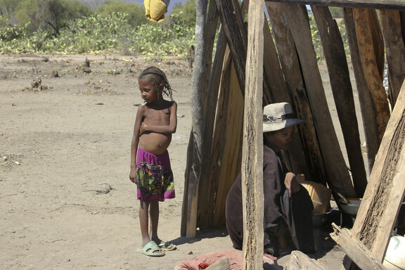 Επισιτιστική κρίση στη Μαδαγασκάρη: «Υπάρχουν περιπτώσεις παιδιών που ουσιαστικά δεν έχουν άλλη σάρκα. Υπάρχει μόνο ο σκελετός και το δέρμα»