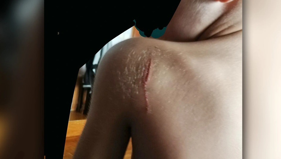 Εύοσμος Θεσσαλονίκης: Μαχαίρωσαν 11χρονο μαθητή - Εχθές δέχτηκε επίθεση και απειλές