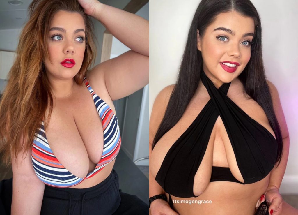 Viral η 26χρονη που το ένα στήθος της είναι διπλάσιο από το άλλο – «Δεν ενοχλεί τους συντρόφους μου»