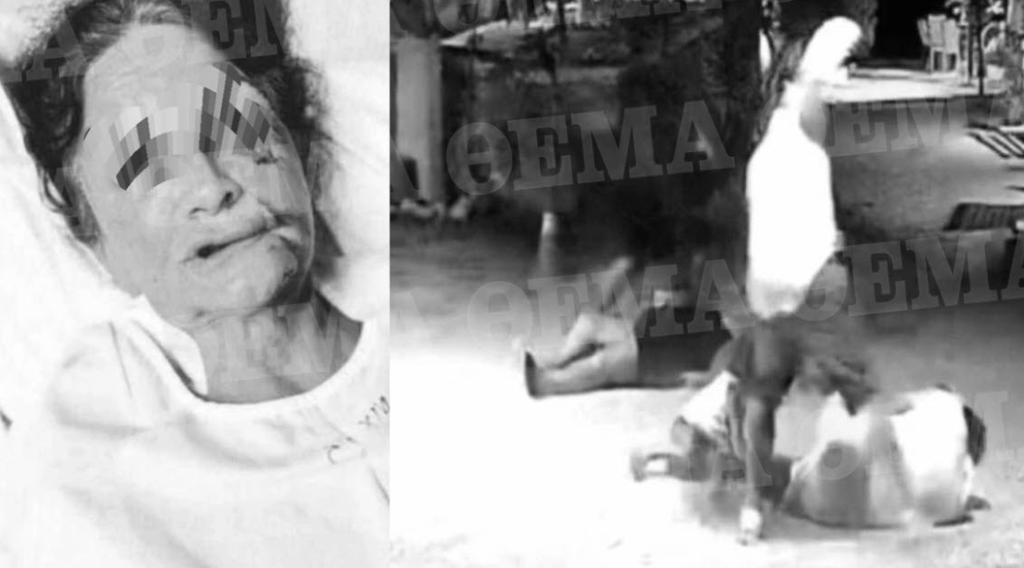Αίγινα: Φωτογραφίες-ντοκουμέντο από τον άγριο ξυλοδαρμό του ξενοδόχου